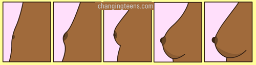 How breasts develop at puberty